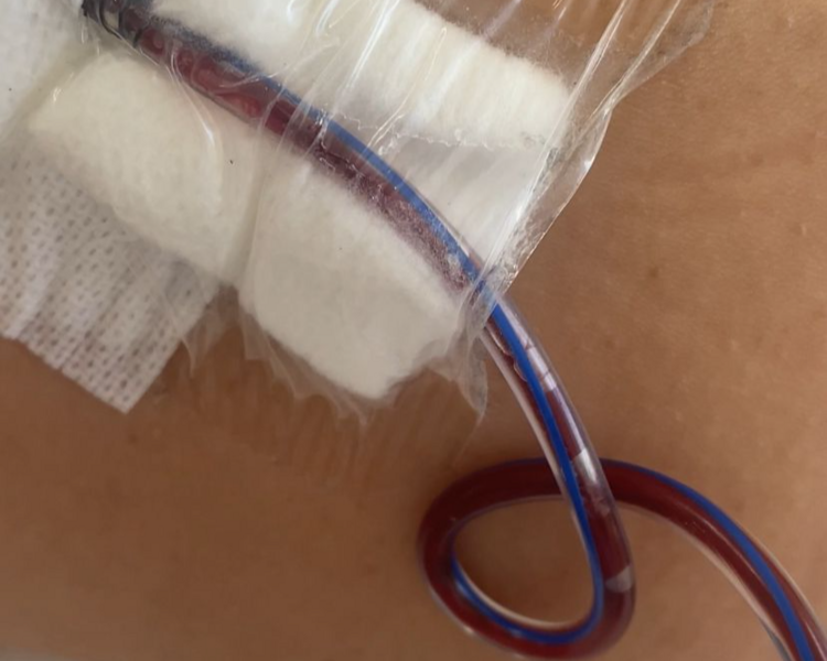 Rehabilitación Dermatofuncional (1 hora)