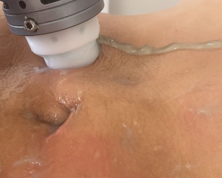 Rehabilitación Dermatofuncional (45 min)