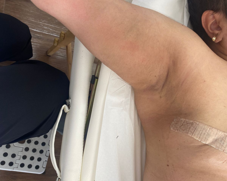 Rehabilitación Oncologica 