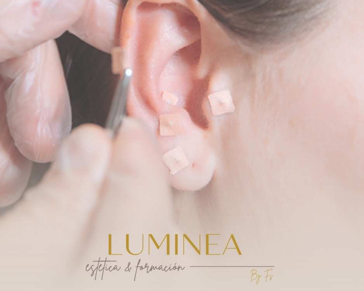 Auriculoterapia control 