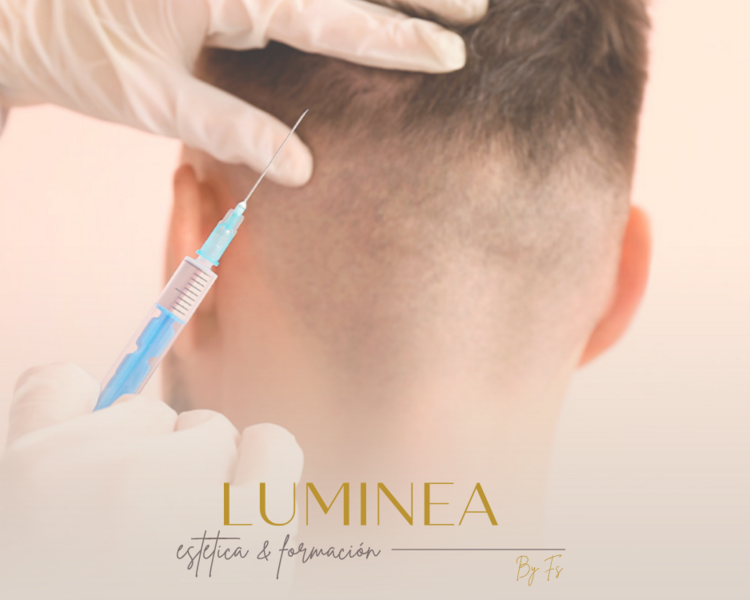 Mesoterapia capilar