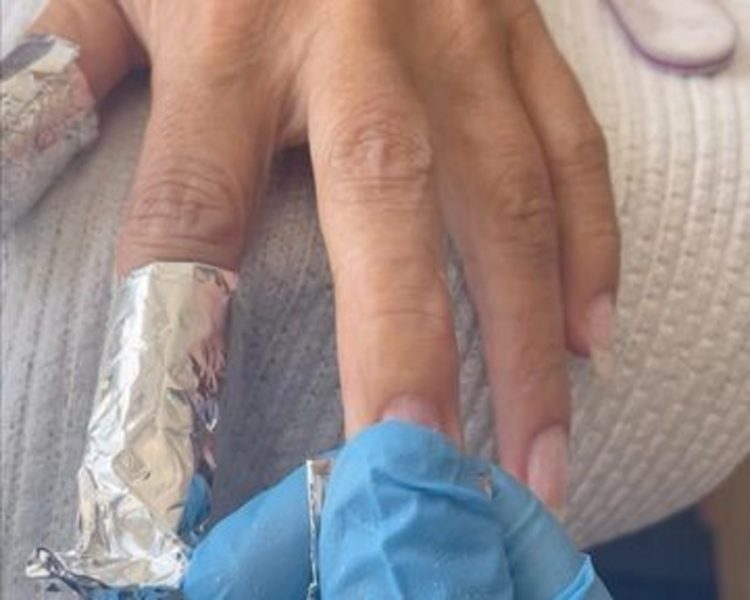 Retiro Semipermanente