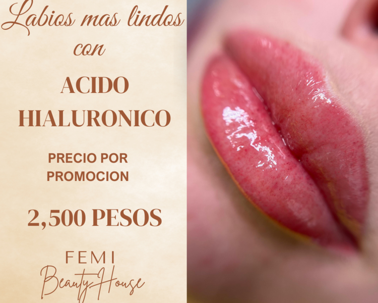 Acido Hialuronico en Labios