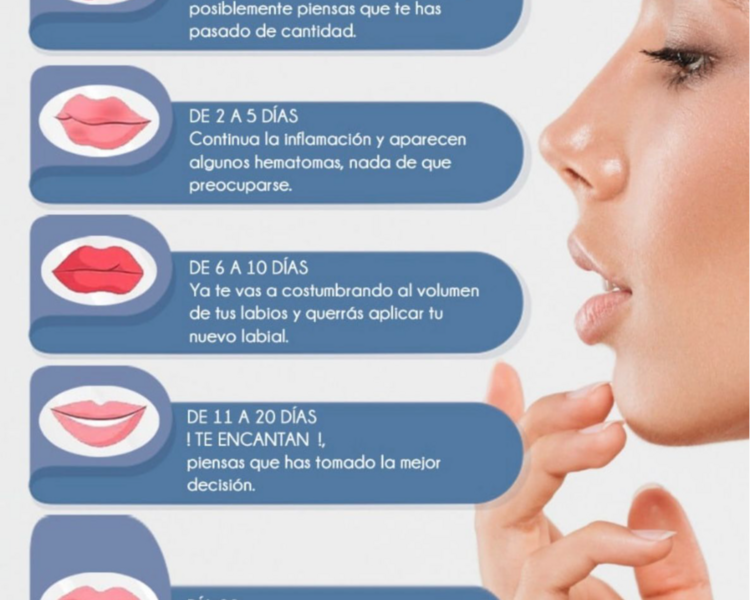 RELLENO ACIDO HIALURONICO