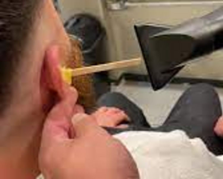 Depilación de Oídos 