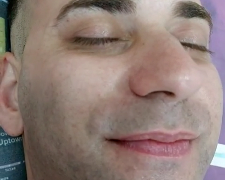 ✨Limpieza Facial Profunda + Extracciones – Sentí tu piel renovada y luminosa