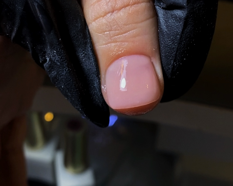 Reconstrucción de Uñas