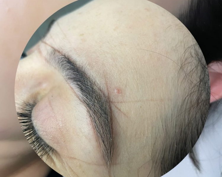 Mirada completa (incluye lifting, botox, laminado y perfilado)