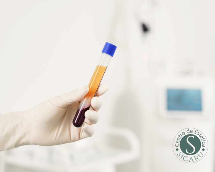 Plasma capilar + vitaminas 5 sesiones
