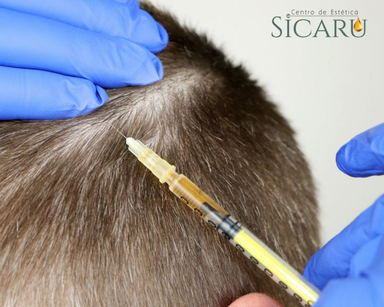 Plasma capilar + vitaminas 5 sesiones