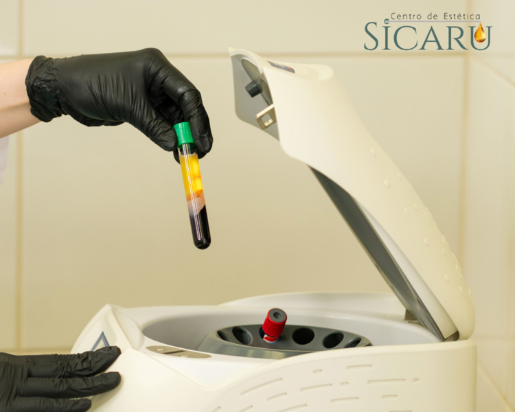 Plasma capilar + vitaminas 1 sesión