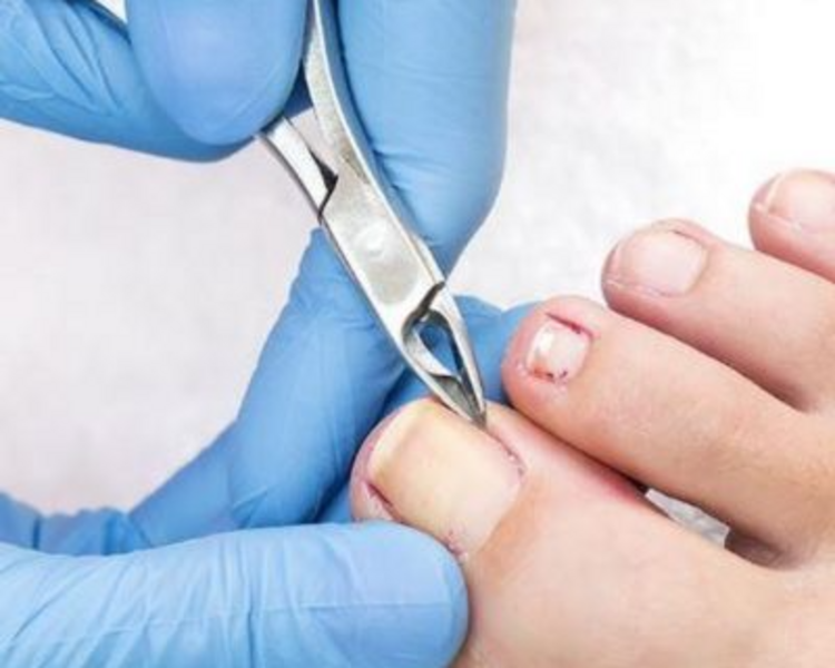 Podología clínica/ Servicio a domicilio 