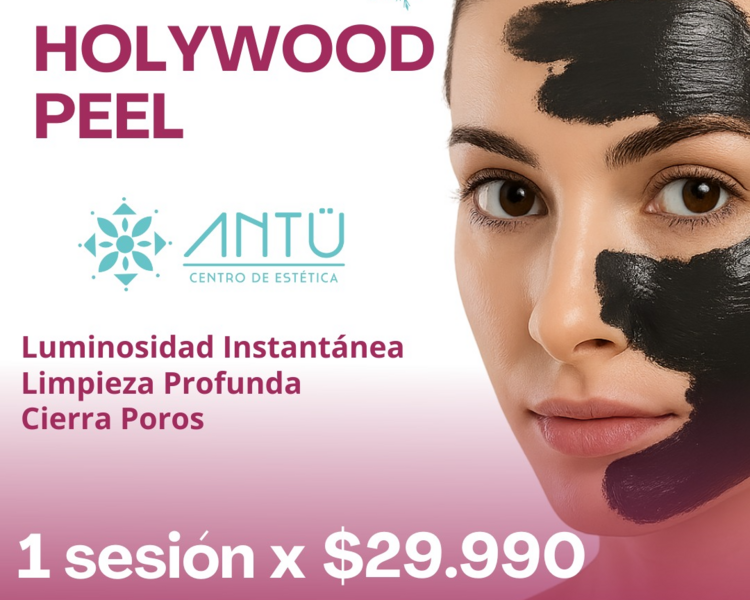 Pelling Hollywood 