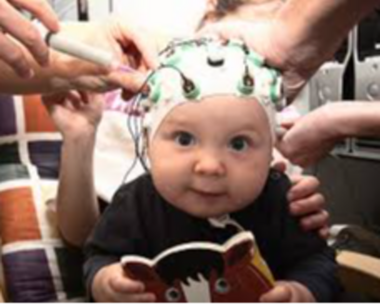 Consulta Orden de Electroencefalograma e Informe programa