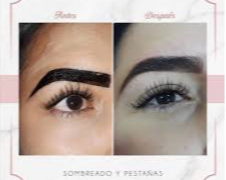 *-*-TERAPIAS DE HIDRATACION*-*