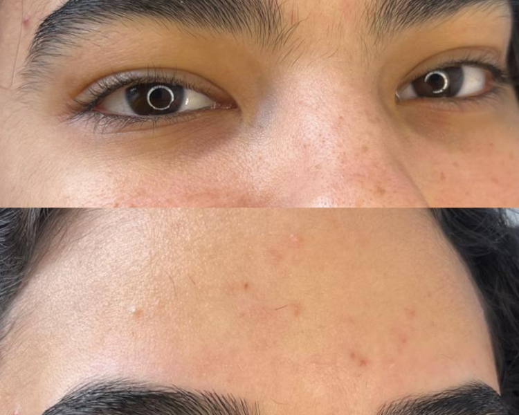 Diseño de cejas Classic 🥇