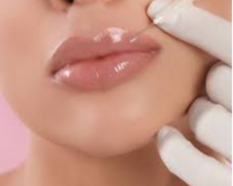 RELLENO DE LABIOS
