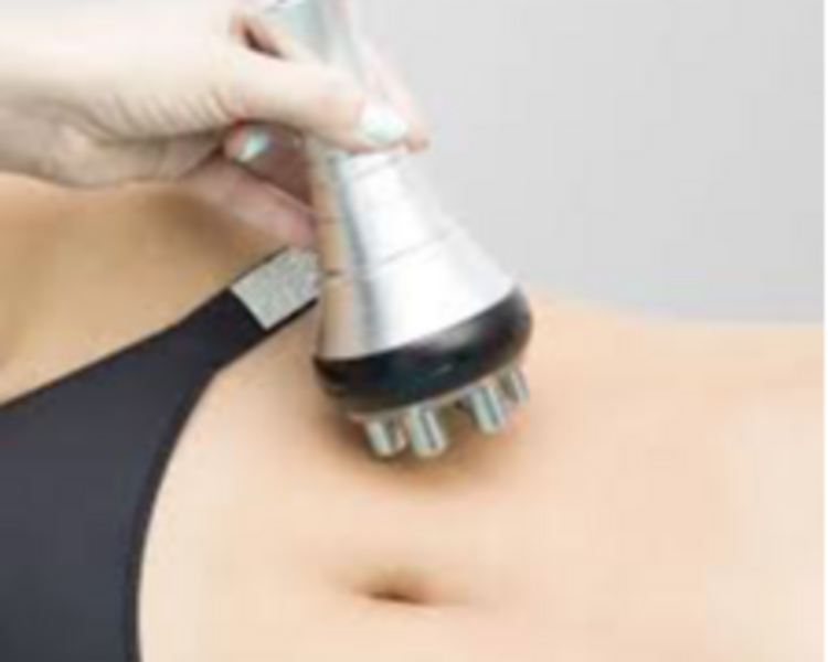 Lipoescultura pack 1 (+2 sesiones lipolitico enzimático)