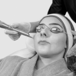 Láser Q-Switched photo