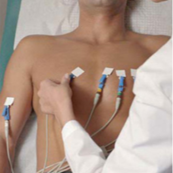 Electrocardiograma con informe