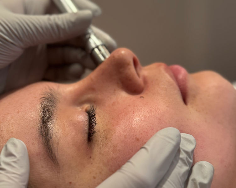 FACIAL SUNSET (especial de temporada) 