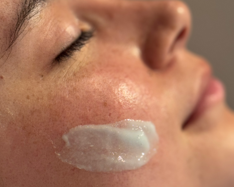 Limpieza profunda personalizada + Microdermoabrasión 