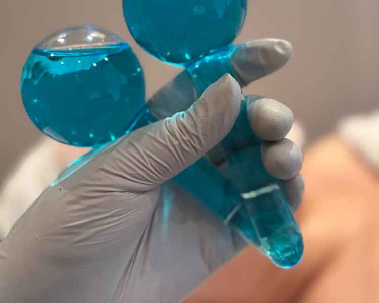 Lifting facial (rejuvenecimiento) con DERMIA 5.0