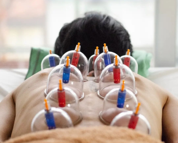 Sesión de Medicina China en Pareja