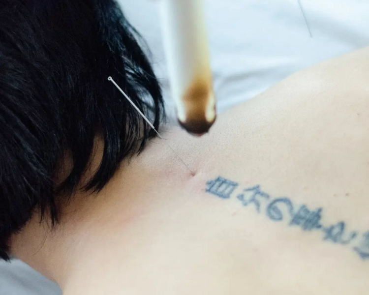 Sesión Integral de Medicina Tradicional China
