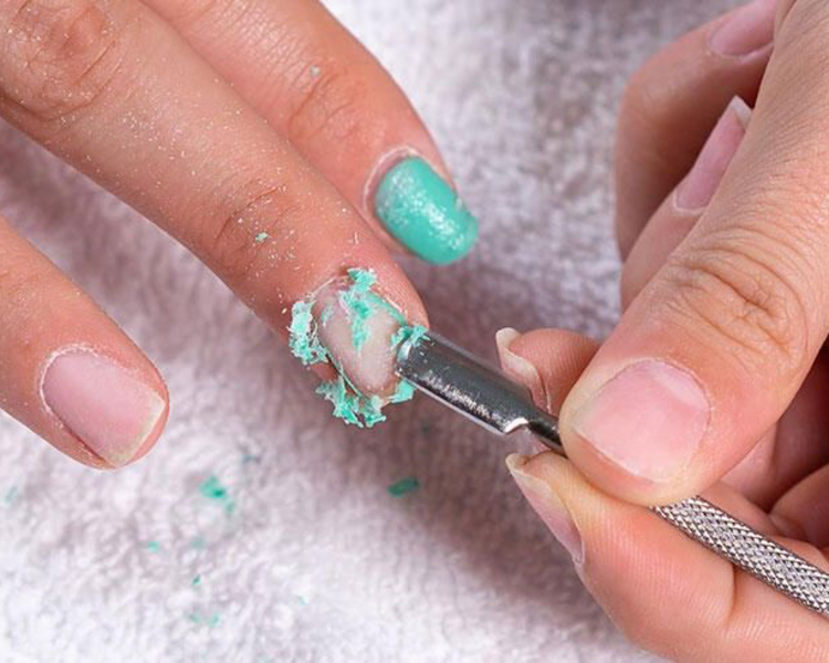 Retiro de Gel Externo