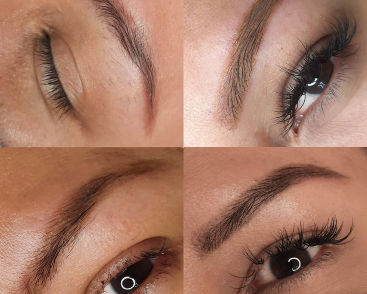 Neutralización de cejas