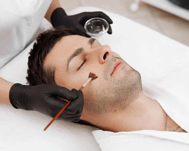 🧼 Peeling Médico – Renovación profunda de la piel 🧼 