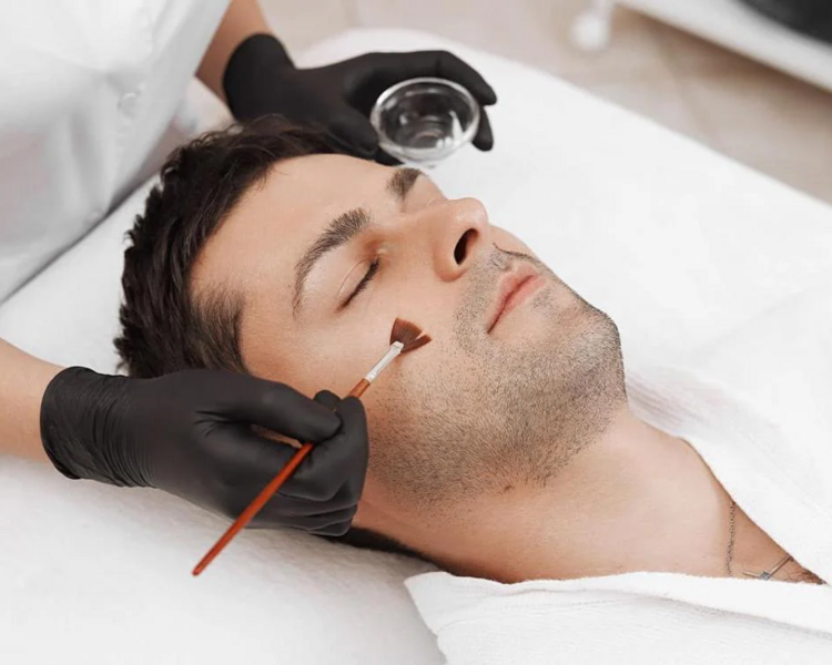 🧼 Peeling Médico – Renovación profunda de la piel 🧼 
