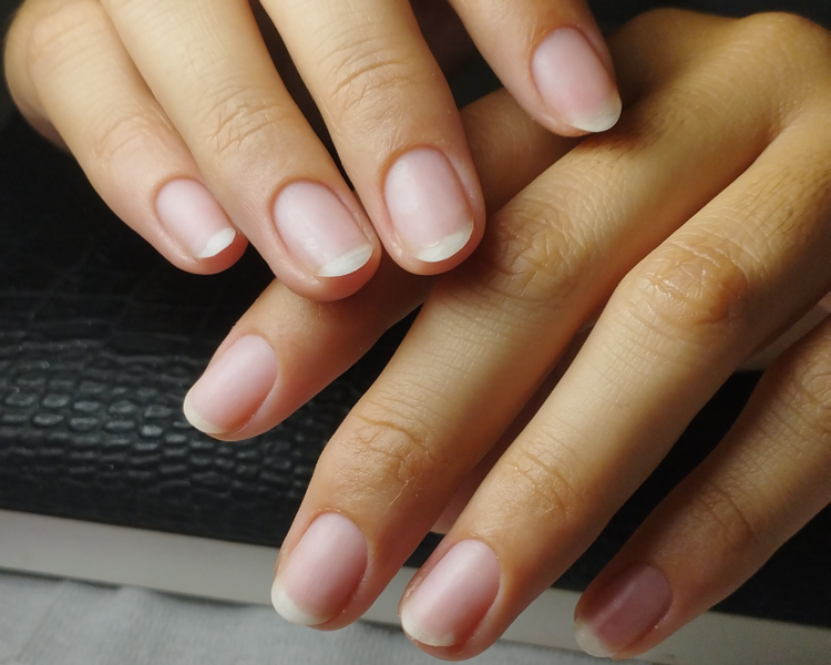 Estética