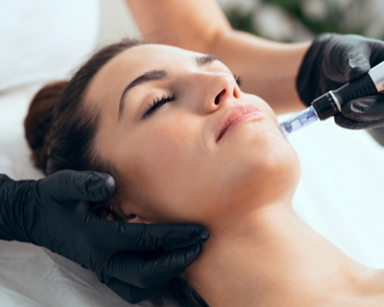 💧 Mesoterapia Facial – Hidratación y Luminosidad (Rejuvenecimiento de la piel)