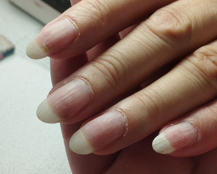 Retiro Capping o Soft Gel