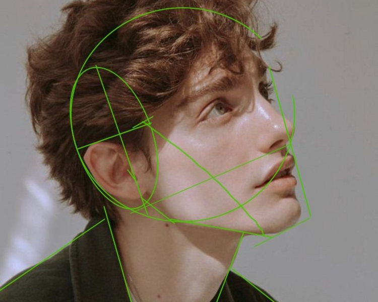 Armonización facial masculina -Protocolo ADONIS® 