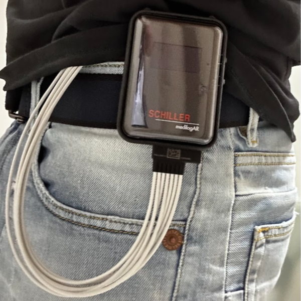 Holter de ritmo 24 horas
