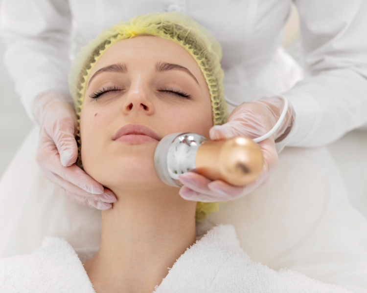 Radiofrecuencia Facial