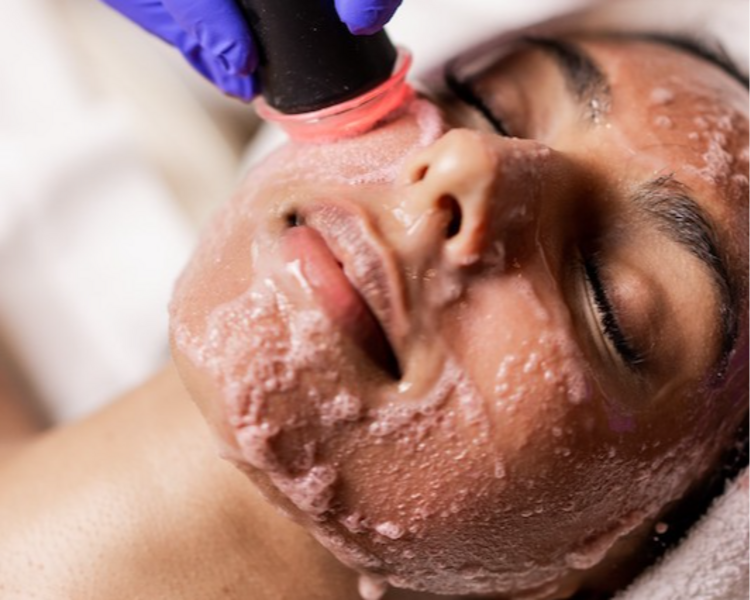 Facial Oxygeneo
