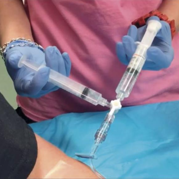 Ecocardiograma doppler con Test de burbujas