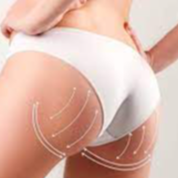 PAQUET LEVANTAMIENTO DE GLUTEOS 10 SESIONES