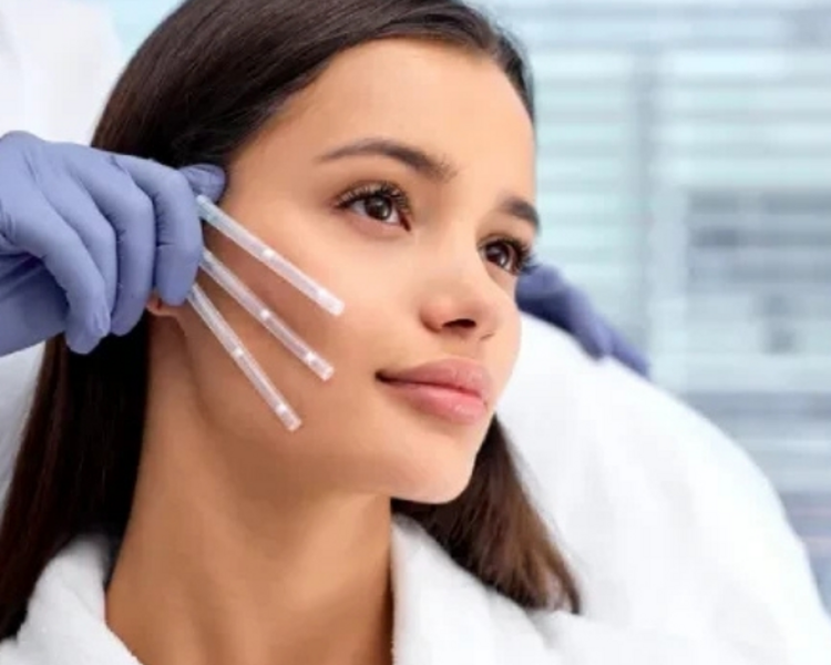 Lifting full face con Hilos de tracción (Tercio medio/inferior)