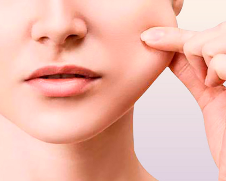 Bichectomía quirúrgica