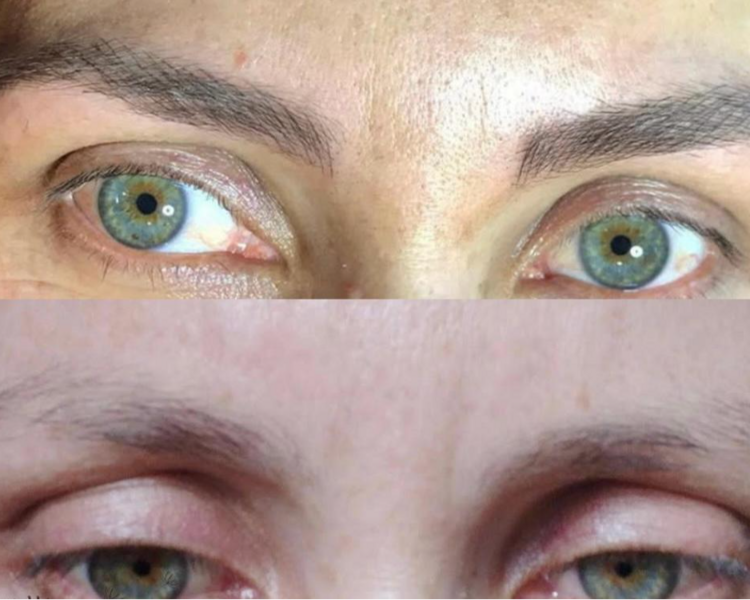 MICROBLADING