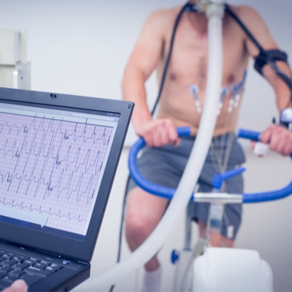 Ecocardiograma de esfuerzo (ejercicio)