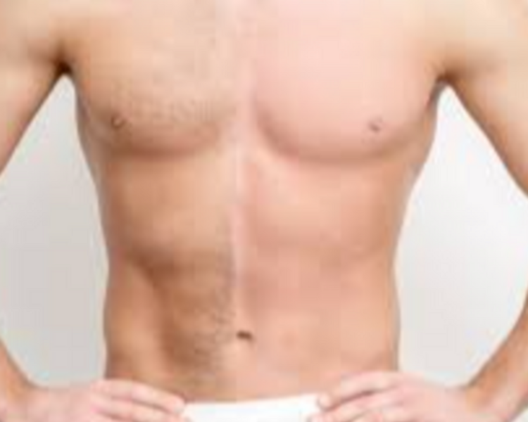 💪 Torso Impecable, Sin Vello 💪 Depilación Definitiva de Pecho + Abdomen – Estética masculina sin esfuerzo