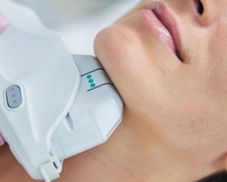 ULTRAHIFU 12D Papada, 60% OFF