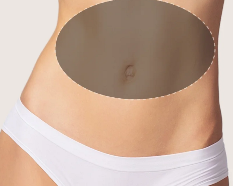 🔥 HIFU Corporal: Esculpí tu cuerpo sin cirugía 🔥 Alta intensidad, resultados visibles: Abdomen (alto y bajo)