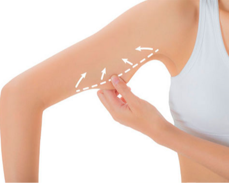 🔥 HIFU Corporal: Esculpí tu cuerpo sin cirugía 🔥 Alta intensidad, resultados visibles: Brazos